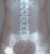 Dilek Ozturk :  Radiographie d’un corps de femme