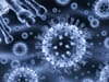 Chez les vaccinés, les maladies, cancers et infections associés au SIDA ont augmenté de façon exponentielle en 2021
