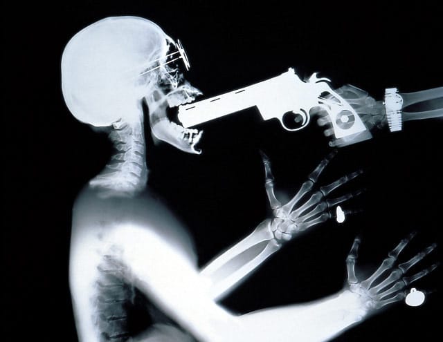 1996_xray_1