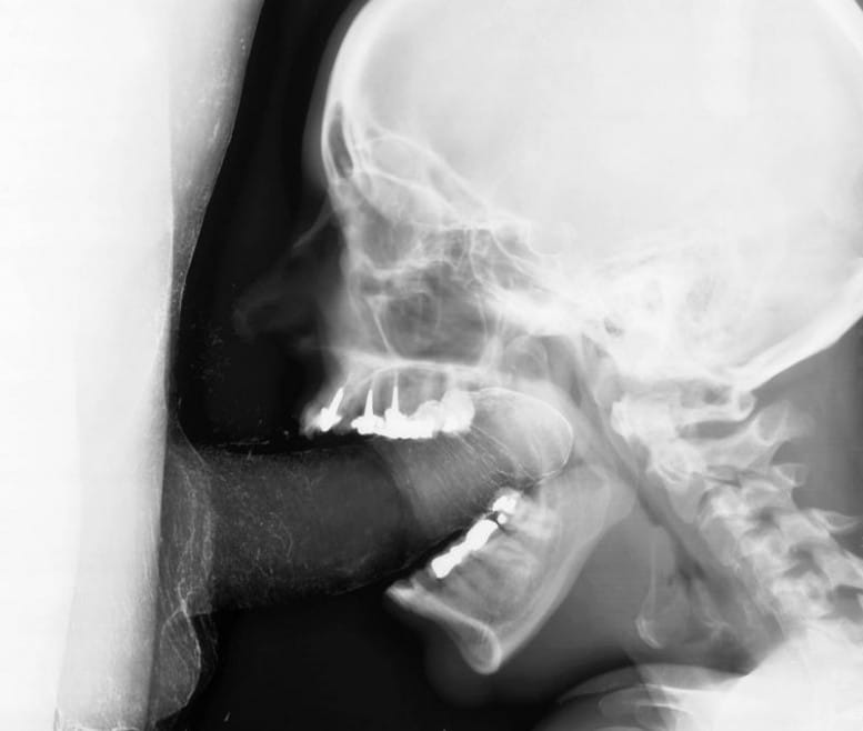 Wim_Delvoye_sexrays-777x658