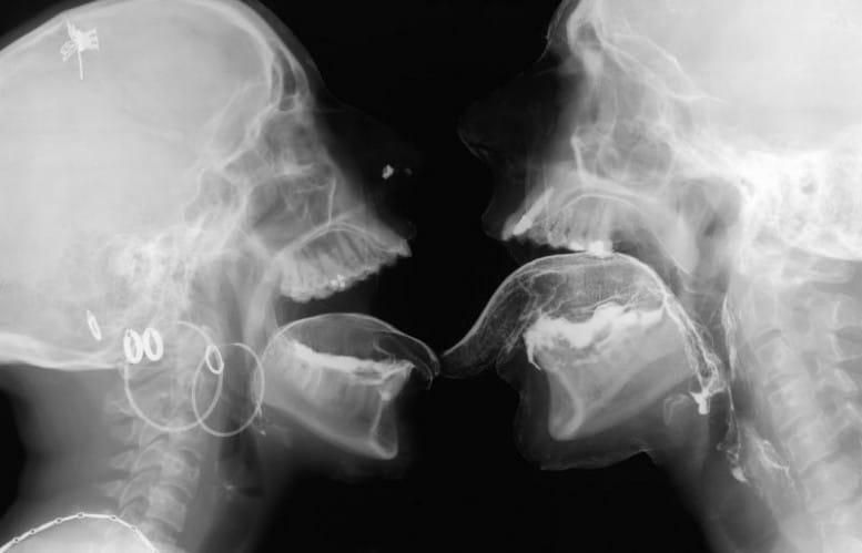 Wim_Delvoye_sexrays_2-777x499