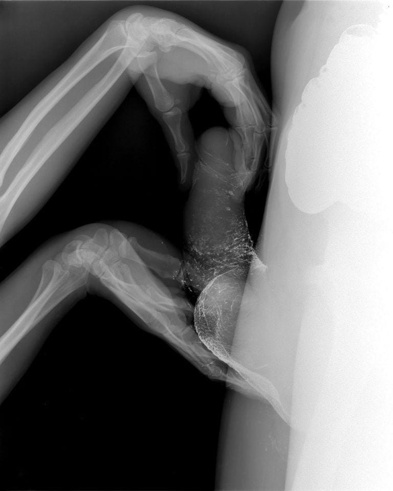 Wim_Delvoye_sexrays_5