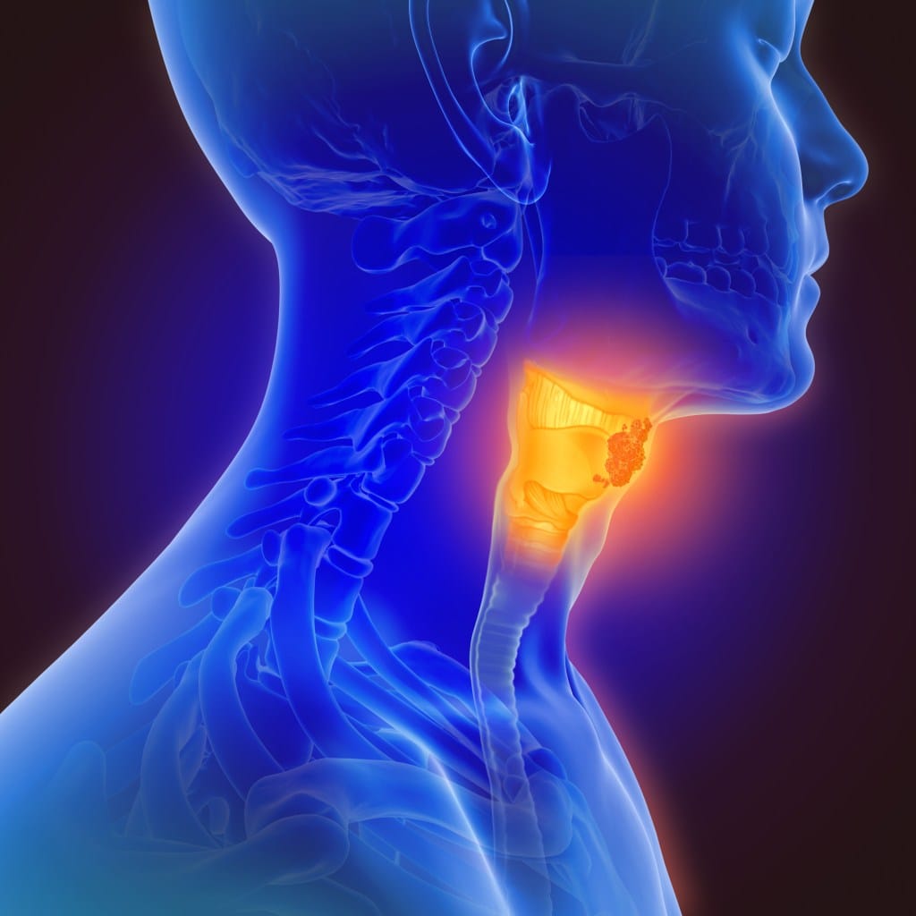 Image numérique d'une personne souffrant de maux de gorge
